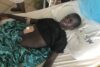Lors d’un massacre perpétré par des islamistes peuls dans dix villages chrétiens de l’État fédéré de Plateau (centre du Nigéria) en juin 2018, Shom a été grièvement blessé. Il a malgré tout réussi à se rendre à l’hôpital. (csi)