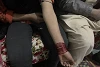 Les nombreuses cicatrices sur le bras gauche de Tabeeta témoignent des mauvais traitements qu’elle a subis. csi